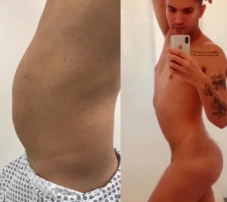 Aretuza Lovi Exibe Antes E Depois De Lipo E Cirurgia No Bumbum Fotos