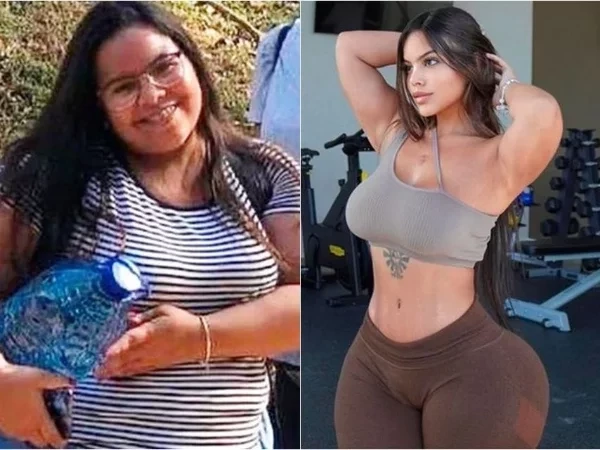 Modelo Elimina Kg E Surpreende Ao Exibir Antes E Depois Fotos