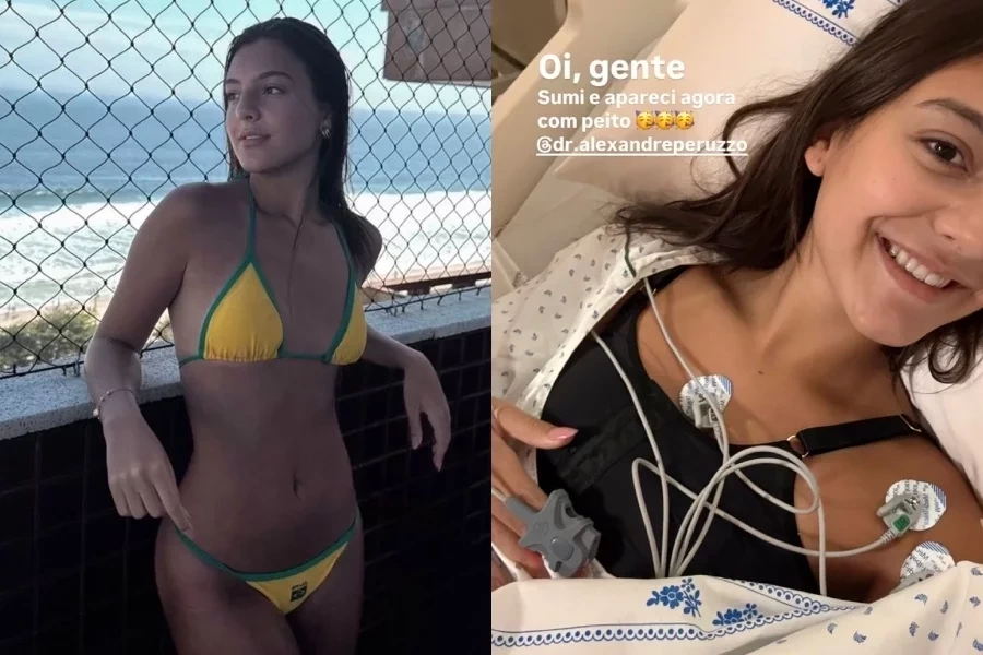 Aos 15 anos, influenciadora Antonela Braga coloca silicone: “Não cresceria mais”