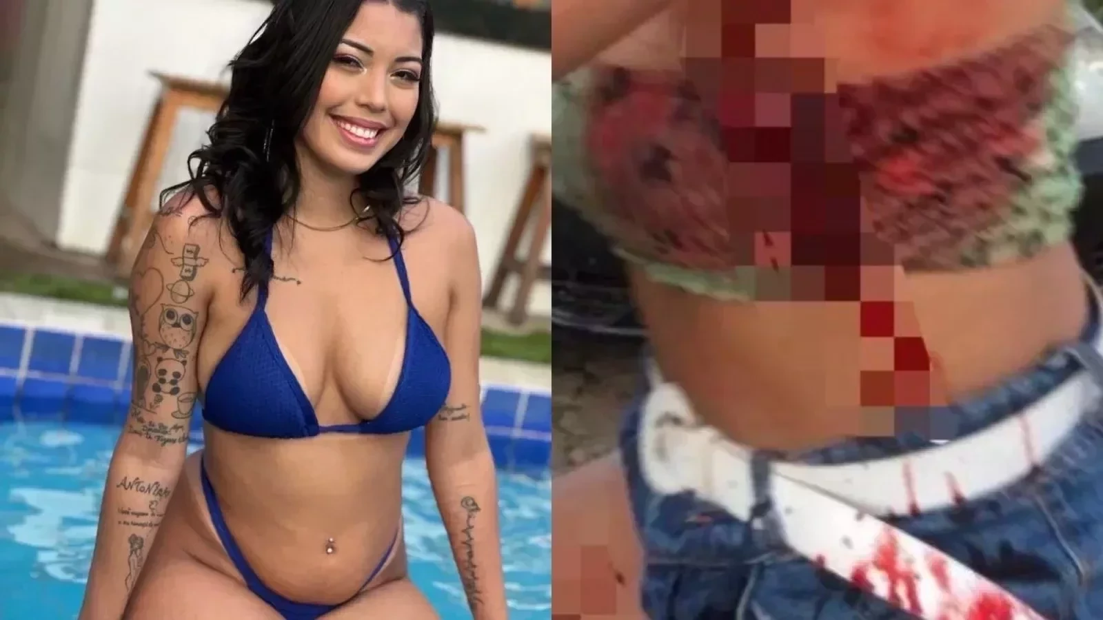 Foto mostra a blogueira Ana Azevedo ferida após ser perfurada | FOTO: Redes Sociais