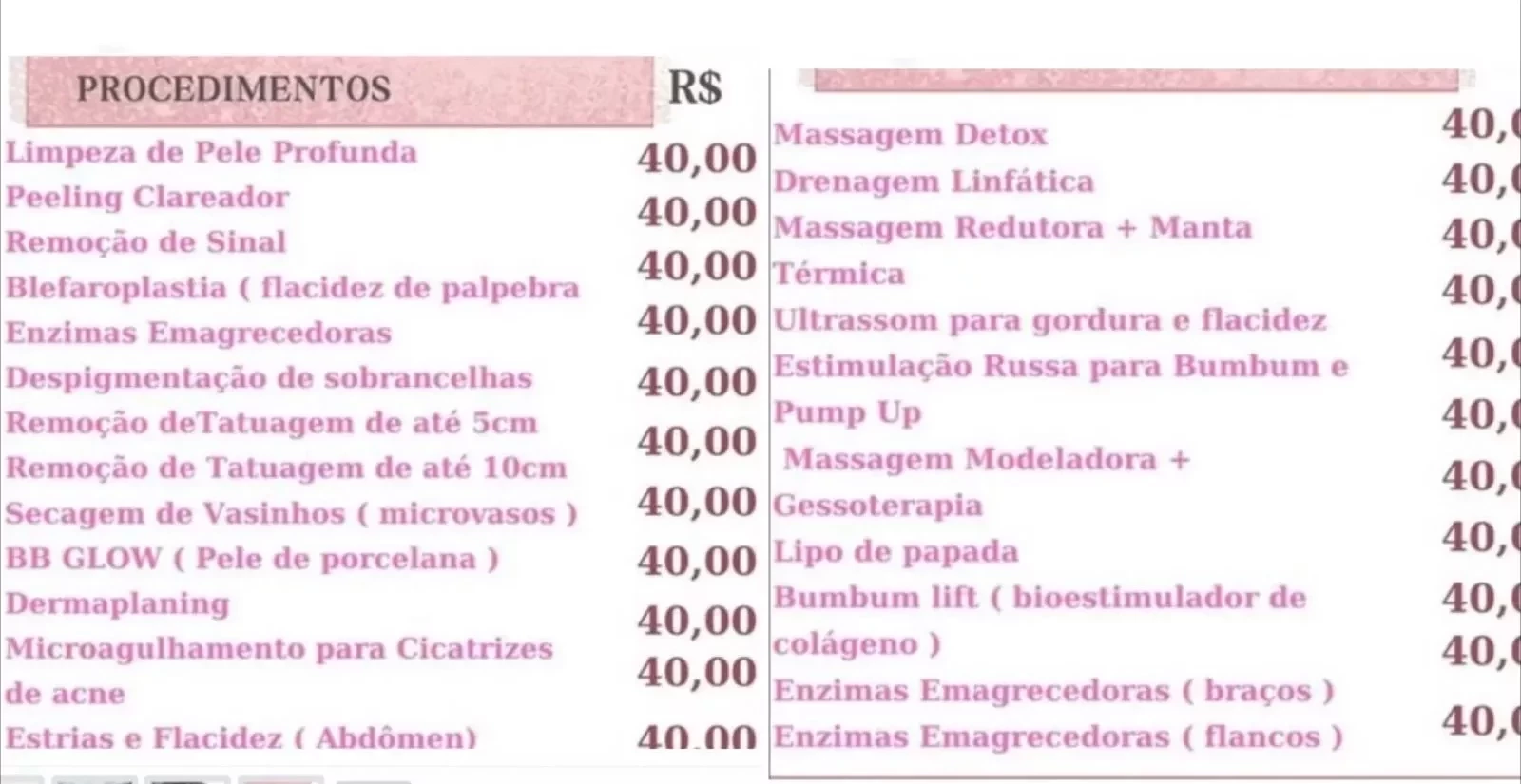 Tabela de preços da clínica de estética (Foto: Reprodução)